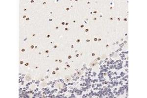 Immunohistochemistry analysis of paraffin-embedded mouse cerebellum using,SETD2 (ABIN7075582) at dilution of 1: 3600