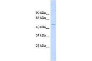 Image no. 1 for anti-Drebrin-Like (DBNL) (AA 251-300) antibody (ABIN6743772) (DBNL Antikörper  (AA 251-300))