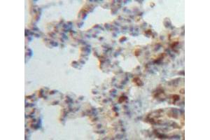 Immunohistochemistry (IHC) image for anti-ADAM Metallopeptidase with thrombospondin Type 1 Motif, 8 (ADAMTS8) (AA 832-889) antibody (ABIN1077728)