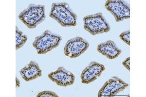IHC analysis of MRE11 using anti-MRE11 antibody (ABIN7600025). (Mre11 Antikörper  (AA 14-481))