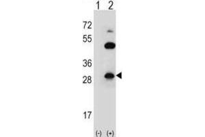 Western Blotting (WB) image for anti-Claudin 2 (CLDN2) antibody (ABIN2996861) (Claudin 2 Antikörper)