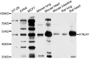 Western blot analysis of extracts of various cell lines, using IFNLR1 antibody (ABIN4904012) at 1:1000 dilution.