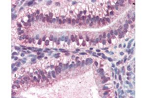Anti-CRABP2 antibody IHC of human uterus. (CRABP2 Antikörper  (AA 1-138))