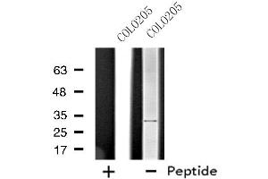 Western blot analysis of extracts from COLO205 cells, using STARD10 antibody.