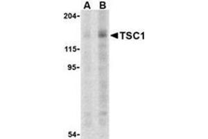 Western blot analysis of TSC1 in C2C12 cell lysate with this product at (A) 2 and (B) 4 μg. (TSC1 Antikörper  (C-Term))