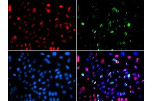 Immunofluorescence (IF) image for anti-Tumor Protein P53 (TP53) (pSer15) antibody (ABIN3023601) (p53 Antikörper  (pSer15))