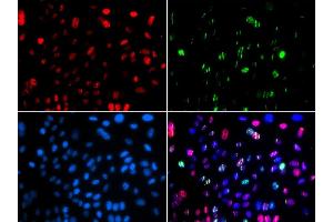 Immunofluorescence (IF) image for anti-Tumor Protein P53 (TP53) (pSer15) antibody (ABIN3023601) (p53 Antikörper  (pSer15))