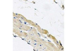 Immunohistochemical analysis of Cytochrome P450 2F1 staining in mouse lung formalin fixed paraffin embedded tissue section.