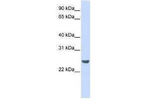 NKIRAS1 antibody used at 1 ug/ml to detect target protein. (NKIRAS1 Antikörper  (N-Term))