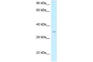Western Blot showing Six1 antibody used at a concentration of 1. (SIX Homeobox 1 Antikörper  (N-Term))