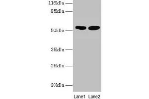 Western blot All lanes: SVOPL antibody at 2 μg/mL Lane 1: Mouse liver tissue Lane 2: Rat liver tissue Secondary Goat polyclonal to rabbit IgG at 1/10000 dilution Predicted band size: 54, 37 kDa Observed band size: 54 kDa (SVOPL Antikörper  (AA 73-129))