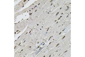 Immunohistochemistry of paraffin-embedded mouse heart using CTNNB1 antibody (ABIN4903403) at dilution of 1:100 (40x lens). (CTNNB1 Antikörper)