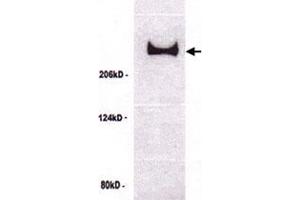 Western blot analysis of TP53BP1 in untreated U-2 OS cell lysate with TP53BP1 polyclonal antibody . (TP53BP1 Antikörper)