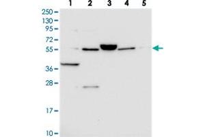 Western blot analysis of Lane 1: RT-4, Lane 2: U-251 MG, Lane 3: Human Plasma, Lane 4: Liver, Lane 5: Tonsil with C10orf129 polyclonal antibody . (C10ORF129 Antikörper)