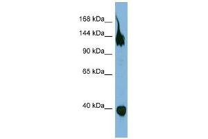 SEMA6A antibody used at 1 ug/ml to detect target protein.