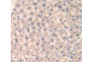 IHC-P analysis of Human Tissue, with DAB staining. (FRS2 Antikörper  (AA 239-449))