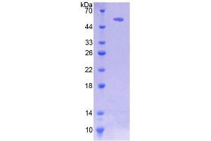 SDS-PAGE (SDS) image for Heat shock factor protein 2 (HSF2) (AA 294-518) protein (His tag,GST tag) (ABIN6236652) (HSF2 Protein (AA 294-518) (His tag,GST tag))