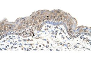 Immunohistochemistry (IHC) image for anti-TAP Binding Protein (Tapasin) (TAPBP) (C-Term) antibody (ABIN2782218)