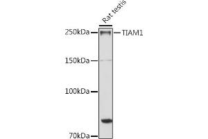 Western blot analysis of extracts of Rat testis, using TI antibody (ABIN6130725, ABIN6149146, ABIN6149147 and ABIN6214431) at 1:1000 dilution. (TIAM1 Antikörper  (AA 1392-1591))