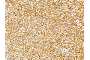 anti-Laminin, alpha 2 (LAMA2) (N-Term) antibody