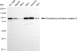 Western blotting analysis using fibroblast growth factor receptor 3 antibody (ABIN7798610). (Rekombinanter FGFR3 Antikörper)