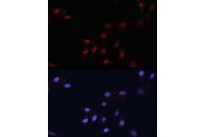 Immunofluorescence analysis of NIH/3T3 cells using p53 antibody (ABIN3017540, ABIN3017541, ABIN3017542 and ABIN6220145) at dilution of 1:100. (p53 Antikörper)