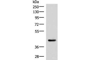 Western blot analysis of Mouse liver tissue lysate using HPN Polyclonal Antibody at dilution of 1:550 (Hepsin Antikörper)