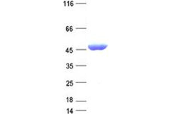 Isocitrate Dehydrogenase Protein (IDH) (DYKDDDDK Tag)