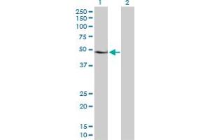 Western Blot analysis of PAX6 expression in transfected 293T cell line by PAX6 MaxPab polyclonal antibody. (PAX6 Antikörper  (AA 1-422))