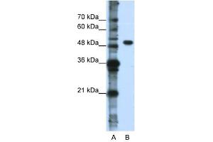 DDX47 antibody used at 0. (DDX47 Antikörper)