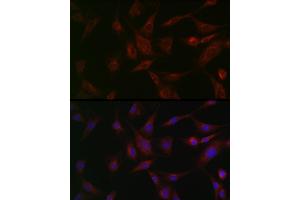 Immunofluorescence analysis of BALB-3T3 cells using NSF Rabbit pAb (ABIN6130571, ABIN6144871, ABIN6144872 and ABIN6214029) at dilution of 1:100 (40x lens). (NSF Antikörper  (AA 1-250))