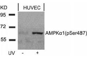 Image no. 4 for anti-Protein Kinase, AMP-Activated, alpha 1 Catalytic Subunit (PRKAA1) (pSer487) antibody (ABIN196905) (PRKAA1 Antikörper  (pSer487))
