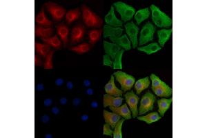 Phospho-Hexokinase 1 (Tyr732) Antibody staining Hela cells(heat shock treatment) by IF/ICC. (Hexokinase 1 Antikörper  (pTyr732))
