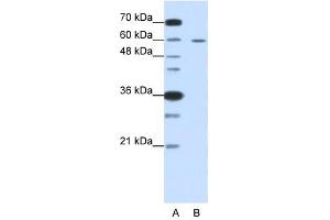 Western Blot showing FZD5 antibody used at a concentration of 1-2 ug/ml to detect its target protein. (FZD5 Antikörper)