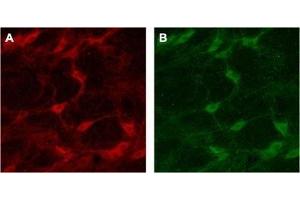 Expression of p75NTR in rat brain - Immunohistochemical staining of rat brain with Anti-p75 NGF Receptor (extracellular) Antibody (ABIN7043344, ABIN7044755 and ABIN7044756). (NGFR Antikörper  (Extracellular))