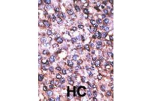 Immunohistochemistry (IHC) image for anti-Melanoma Antigen Family D, 2 (MAGED2) antibody (ABIN3002534) (MAGED2 Antikörper)