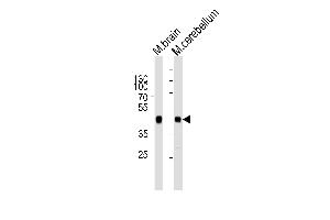 Western blot analysis of lysates from mouse brain and mouse cerebellum tissue lysate (from left to right), using ZDHHC14 Antibody (Center) (ABIN6243381 and ABIN6577546). (ZDHHC14 Antikörper  (AA 283-317))