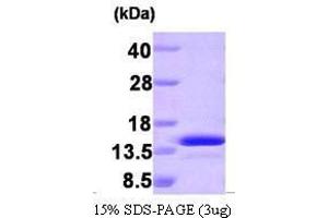 Figure annotation denotes ug of protein loaded and % gel used. (PEA15 Protein (AA 1-130))