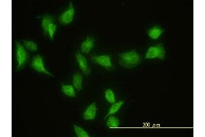 Immunofluorescence (IF) image for anti-G Protein-Coupled Receptor Kinase Interactor 2 (GIT2) (AA 1-471) antibody (ABIN564230)