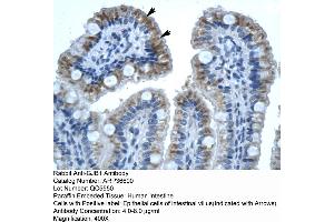 Human Intestine (GJB1 Antikörper  (C-Term))