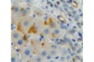 IHC-P analysis of Liver tissue, with DAB staining. (CD8B Antikörper  (AA 22-175))