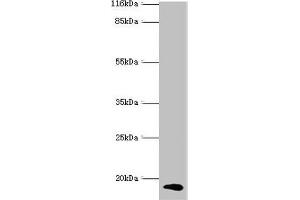 Western blot All lanes: CALML5 antibody at 2 μg/mL + A431 whole cell lysate Secondary Goat polyclonal to rabbit IgG at 1/10000 dilution Predicted band size: 16 kDa Observed band size: 16 kDa