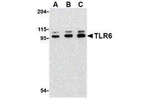 Western Blotting (WB) image for anti-Toll-Like Receptor 6 (TLR6) (Center) antibody (ABIN2479759) (TLR6 Antikörper  (Center))