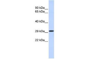 Western Blotting (WB) image for anti-Kruppel-Like Factor 14 (KLF14) antibody (ABIN2458210) (KLF14 Antikörper)