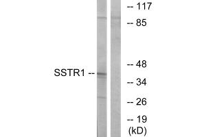 Western blot analysis of extracts from COS-7 cells, using SSTR1 antibody.