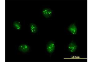 Immunofluorescence of purified MaxPab antibody to PDE9A on HeLa cell. (PDE9A Antikörper  (AA 1-533))