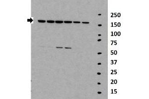 Researcher: Daolin Tang, University of Pittsburgh Medical Center Species+tissue/cell type: Lane 1-6: 30ug mouse MEF lysate Primary antibody dilution: 1:2000 (TNKS Antikörper  (Middle Region))