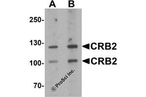 Western Blotting (WB) image for anti-Crumbs Homolog 2 (CRB2) antibody (ABIN1077416) (CRB2 Antikörper)