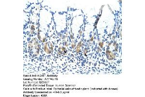 Rabbit Anti-ADAT1 Antibody  Paraffin Embedded Tissue: Human Stomach Cellular Data: Epithelial cells of fundic gland Antibody Concentration: 4. (ADAT1 Antikörper  (C-Term))
