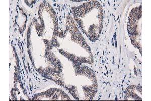 Image no. 1 for anti-Eukaryotic Translation Initiation Factor 4E Family Member 2 (EIF4E2) antibody (ABIN1497992) (EIF4E2 Antikörper)